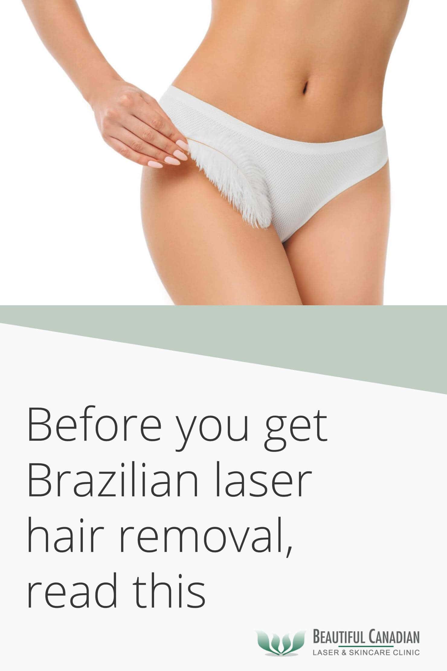 Bikini Before After Photos Of Laser Hair Removal Milan Laser In Boston